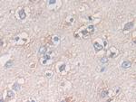 ATF6 Antibody in Immunohistochemistry (Paraffin) (IHC (P))