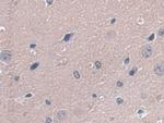 GPX3 Antibody in Immunohistochemistry (Paraffin) (IHC (P))