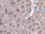 GPX3 Antibody in Immunohistochemistry (Paraffin) (IHC (P))