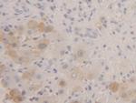 FABP1 Antibody in Immunohistochemistry (Paraffin) (IHC (P))
