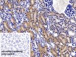 FABP1 Polyclonal Antibody