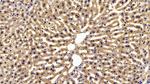 FABP1 Antibody in Immunohistochemistry (Paraffin) (IHC (P))