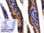 FABP1 Antibody in Immunohistochemistry (Paraffin) (IHC (P))