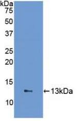 FABP1 Antibody in Western Blot (WB)