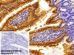 RBP2 Antibody in Immunohistochemistry (Paraffin) (IHC (P))