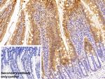 RBP2 Antibody in Immunohistochemistry (Paraffin) (IHC (P))