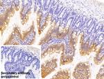 RBP2 Antibody in Immunohistochemistry (Paraffin) (IHC (P))
