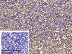 TGF beta-1 Polyclonal Antibody