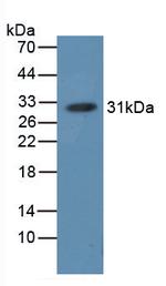 Hemoglobin Antibody in Western Blot (WB)