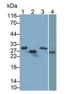 TNNI1 Polyclonal Antibody