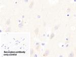 GP6 Polyclonal Antibody