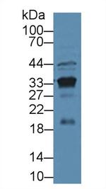 PSA Polyclonal Antibody
