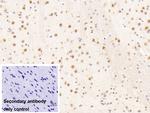 NUP88 Antibody in Immunohistochemistry (Paraffin) (IHC (P))
