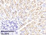 NUP88 Antibody in Immunohistochemistry (Paraffin) (IHC (P))