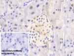 NUP88 Antibody in Immunohistochemistry (Paraffin) (IHC (P))