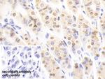 NUP88 Antibody in Immunohistochemistry (Paraffin) (IHC (P))