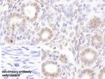 NUP88 Antibody in Immunohistochemistry (Paraffin) (IHC (P))