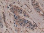 CD200 Antibody in Immunohistochemistry (Paraffin) (IHC (P))
