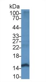 Hemoglobin alpha-1 Antibody in Western Blot (WB)