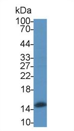 Hemoglobin alpha-1 Antibody in Western Blot (WB)