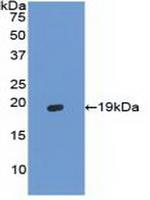 Hemoglobin alpha-1 Antibody in Western Blot (WB)