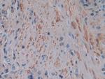 Ferritin Light Chain Antibody in Immunohistochemistry (Paraffin) (IHC (P))