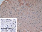 Ferritin Light Chain Antibody in Immunohistochemistry (Paraffin) (IHC (P))