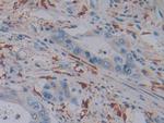 Ferritin Light Chain Polyclonal Antibody