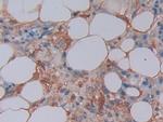 Ferritin Light Chain Antibody in Immunohistochemistry (Paraffin) (IHC (P))