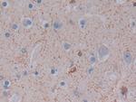 Ferritin Light Chain Antibody in Immunohistochemistry (Paraffin) (IHC (P))