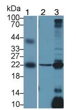 Ferritin Light Chain Antibody in Western Blot (WB)