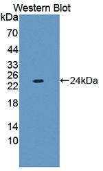 Ferritin Light Chain Antibody in Western Blot (WB)