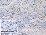 EB1 Antibody in Immunohistochemistry (Paraffin) (IHC (P))