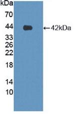 LPHN3 Polyclonal Antibody