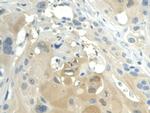 NAMPT Antibody in Immunohistochemistry (Paraffin) (IHC (P))