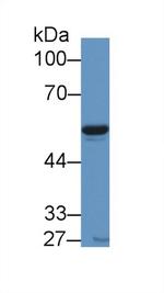 NAMPT Antibody in Western Blot (WB)
