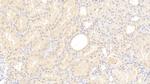 C8G Polyclonal Antibody