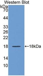 REG1A Antibody in Western Blot (WB)