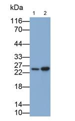 NME5 Antibody in Western Blot (WB)