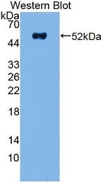 NME5 Antibody in Western Blot (WB)