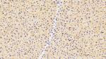 ICAM-1 Antibody in Immunohistochemistry (Paraffin) (IHC (P))