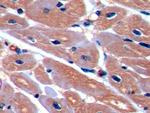 ICAM-1 Antibody in Immunohistochemistry (Paraffin) (IHC (P))