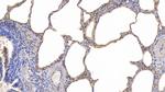 ICAM-1 Antibody in Immunohistochemistry (Paraffin) (IHC (P))