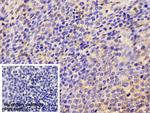 ICAM-1 Antibody in Immunohistochemistry (Paraffin) (IHC (P))