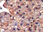ICAM-1 Antibody in Immunohistochemistry (Paraffin) (IHC (P))