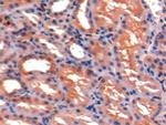 ICAM-1 Antibody in Immunohistochemistry (Paraffin) (IHC (P))