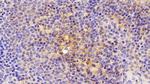 ICAM-1 Antibody in Immunohistochemistry (Paraffin) (IHC (P))