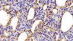 ICAM-1 Antibody in Immunohistochemistry (Paraffin) (IHC (P))