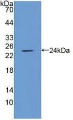 ICAM-1 Antibody in Western Blot (WB)