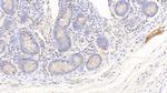 Hemoglobin Antibody in Immunohistochemistry (Paraffin) (IHC (P))
